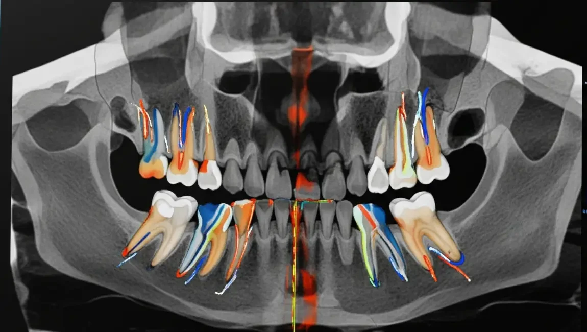 Dental Tomografi CBCT Servisi